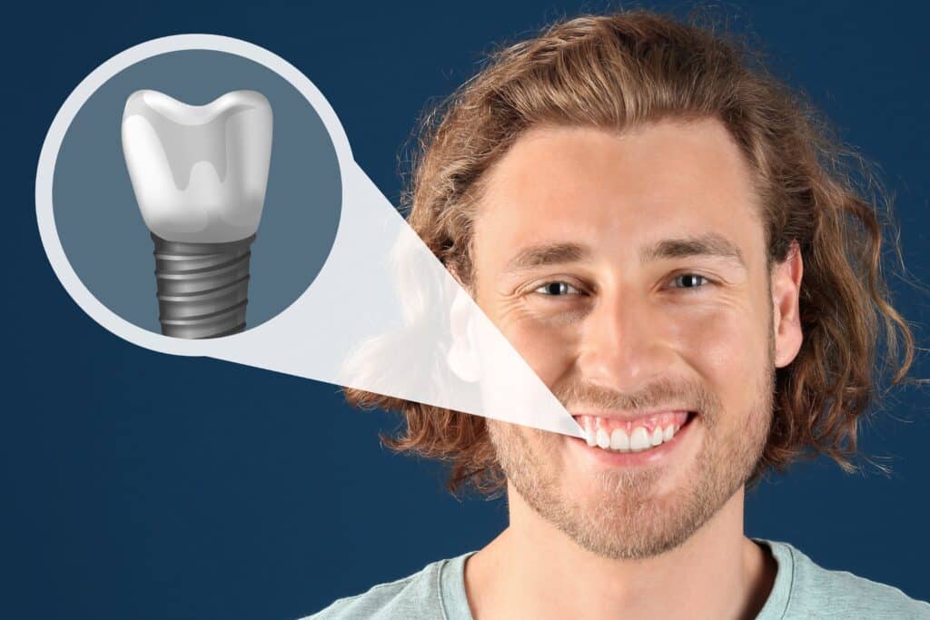 San Antonio Dental Implants
