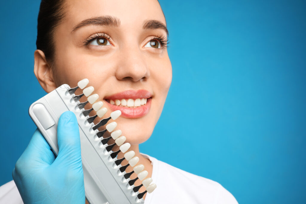 Veneers in San Antonio